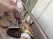 女子为减肥每天只吃1个素包子，饿了就喝水，7天瘦9斤，突发胃疼，止疼针输液都没用，查出急性重症胆囊炎；医生：切忌长时间空腹